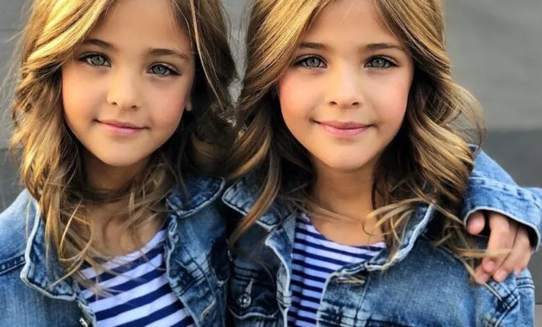 12 Years Ago They Were Called The World’s Most Beautiful Twins – Now Look At Them