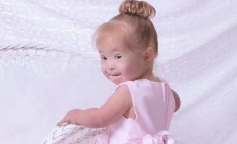 Doctors Wanted To Put Girl With Down Syndrome In An Institution, Look At Her Now As A Top Model